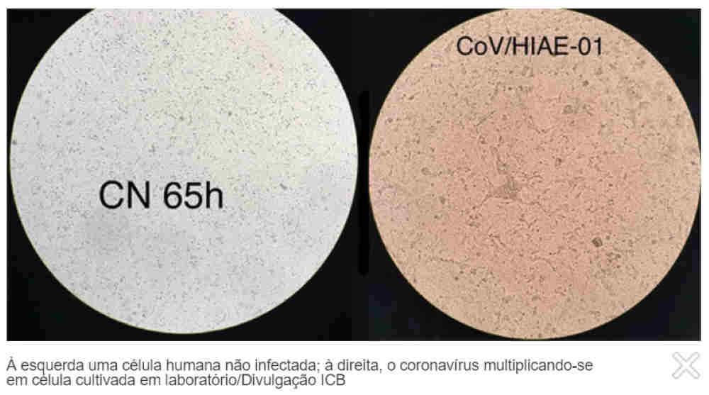 Pesquisadores da USP produzem coronavírus em laboratório
